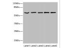 Western blot<br />
All lanes: ASIC3 antibody at 2.4ug/ml<br />
Lane 1 : Jurkat whole cell lysate<br />
Lane 2 : HepG-2 whole cell lysate<br />
Lane 3 : Hela whole cell lysate<br />
Lane 4 : A549 whole cell lysate<br />
Lane 5 : A431 whole cell lysate<br /
