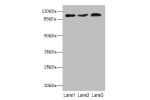 Western blot<br />
All lanes:
