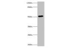All lanes:BAG family molecular chaperone regulator 5 antibody at 1ug/ml<br />
Lane 1:Hela whole cell lysate<br />
Lane 2:jurkat whole cell lysate<br />
Lane 3:A549 whole cell lysate<br />
Secondary<br />
Goat polyclonal to rabbit at 1/10000 dilution<br />