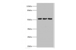 Western blot<br />
All lanes:BAG family molecular chaperone regulator 5 antibody at 2ug/ml<br />
Lane 1:mouse kidney tissue<br />
Lane 2:mouse brain tissue<br />
Lane 3:Hela whole cell lysate<br />
Secondary<br />
Goat polyclonal to rabbit at 1/10000 dilu