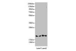 Western blot<br />
All lanes: BLOC1S6 antibody at 3.13 ug/ml<br />
Lane 1 : A431 whole cell lysate<br />
Lane 2 : 293T whole cell lysate<br />
Secondary<br />
Goat polyclonal to rabbit IgG at 1/10000 dilution<br />
Predicted band size: 20,9 kDa<br />
Obse