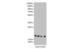 Western blot<br />
All lanes: BLOC1S6 antibody at 3.33 ug/ml<br />
Lane 1 : A431 whole cell lysate<br />
Lane 2 : 293T whole cell lysate<br />
Secondary<br />
Goat polyclonal to rabbit IgG at 1/10000 dilution<br />
Predicted band size: 20,9 kDa<br />
Obse