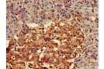Immunohistochemistry of paraffin-embedded human pancreatic tissue using CSB-PA890755LA01HU at dilution of 1:100