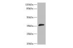Western blot<br />
All lanes:DHDH antibody at 1.4ug/ml+mouse liver tissue<br />
Secondary<br />
Goat polyclonal to rabbit at 1/10000 dilution<br />
Predicted band size: 36kDa<br />
Observed band size: 36kDa<br />
