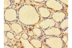 Immunohistochemistry of paraffin-embedded CSB-PA890914LA01HU using human thyroid tissue at dilution 1:100