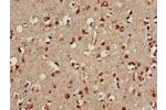 Immunohistochemistry of paraffin-embedded human brain tissue using CSB-PA890918LA01HU at dilution of 1:100