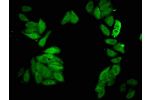 Immunofluorescent analysis of HepG2 cells using CSB-PA891530LA01HU at a dilution of 1:100 and Alexa Fluor 488-congugated AffiniPure Goat Anti-Rabbit IgG(H+L)