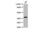 Western Blot<br />
Positive WB detected in:U87 whole cell lysate<br />
All lanes:GJD2 antibody at 3.2