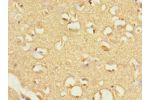 Immunohistochemistry of paraffin-embedded human brain tissue using CSB-PA891538ESR2HU at dilution 1:100