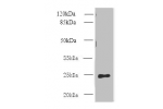 Western blot<br />
All lanes: CLEC4E antibody at 0.3ug/ml+ Mouse spleen tissue<br />
Goat polyclonal to rabbit at 1/10000 dilution<br />
Predicted band size: 25 kDa<br />
Observed band size: 25 kDa<br />