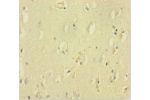 Immunohistochemistry of paraffin-embedded human brain tissue using CSB-PA891564LA01HU at dilution 1:100