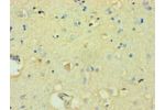 Immunohistochemistry of paraffin-embedded human brain using CSB-PA891721ESR2HU at dilution 1:100