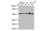 Western Blot<br />
Positive WB detected in:HepG2 whole cell lysate,K562 whole cell lysate,Hela whole cell lysate,Mouse liver tissue,Mouse kidney tissue<br />
All lanes:FBXW2 antibody at 3