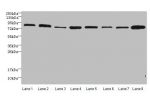 Western blot<br />
All lanes: Protein argonaute-2 antibody at 2ug/ml<br />
Lane 1: A549 whole cell lysate<br />
Lane 2: Jurkats whole cell lysate<br />
Lane 3: MCF-7 whole cell lysate<br />
Lane 4: HepG2 whole cell lysate<br />
Lane 5: Raw264.7 whole cell