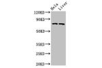 Western Blot<br />
Positive WB detected in:Hela whole cell lysate,Rat liver tissue<br />
All lanes:ACSL5 antibody at 3