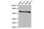 Western Blot<br />
Positive WB detected in:A549 whole cell lysate,Hela whole cell lysate,HepG2 whole cell lysate,MCF-7 whole cell lysate<br />
All lanes:FZD10 antibody at 3