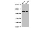 Western Blot<br />
Positive WB detected in:A549 whole cell lysate,HepG2 whole cell lysate<br />
All lanes:CNTN6 antibody at 2.7