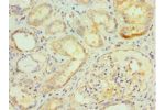 Immunohistochemistry of paraffin-embedded human kidney using CSB-PA891942ESR2HU at dilution 1:100