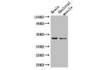 Western Blot<br />
Positive WB detected in:Mouse brain tissue,Mouse skeletal muscle tissue<br />
All lanes: AJAP1 antibody at 2.7ug/ml<br />
Secondary<br />
Goat polyclonal to rabbit IgG at 1/50000 dilution<br />
Predicted band size: 45 kDa<br />
Observed