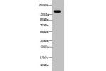 Western blot<br />
All lanes:ADAMTS7 antibody at 2ug/ml+Mouse brain tissue<br />
Secondary<br />
Goat polyclonal to rabbit at 1/10000 dilution<br />
Predicted band size: 184kDa<br />
Observed band size: 184kDa<br />