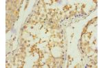 Immunohistochemistry of paraffin-embedded human testis tissue CSB-PA891968DSR2HU at dilution 1:100