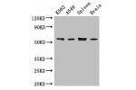 Western Blot<br />
Positive WB detected in:K562 whole cell lysate,A549 whole cell lysate,Mouse spleen tissue,Mouse brain tissue<br />
All lanes: CORO1C antibody at 3.4ug/ml<br />
Secondary<br />
Goat polyclonal to rabbit IgG at 1/50000 dilution<br />
Pred