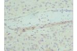 Immunohistochemistry of paraffin-embedded human liver tissue using CSB-PA891990ESR2HU at dilution 1:100