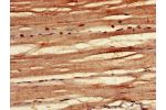 Immunohistochemistry of paraffin-embedded human skeletal muscle tissue using CSB-PA892132LA01HU at dilution of 1:100