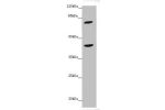 Western blot<br />
All lanes:ACSL6 antibody at 4.25 ug/ml<br />
 + Mouse liver tissue<br />
Secondary<br />
Goat polyclonal to rabbit IgG at 1/10000 dilution<br />
Predicted band size: 78,81,75,77,80,70 kDa<br />
Observed band size: 78,42 kDa<br />
