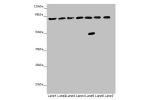 Western blot<br />
All lanes: ACSL6 antibody at 4.64 ug/ml<br />
Lane 1 : Mouse liver tissue<br />
Lane 2 : Mouse heart tissue<br />
Lane 3 : Mouse brain tissue<br />
Lane 4 : Mouse gonadal tissue<br />
Lane 5 : Jurkat whole cell lysate<br />
Lane 6 : Raj
