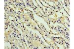 Immunohistochemistry of paraffin-embedded human lung using CSB-PA892152ESR1HU at dilution 1:100