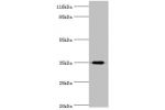 Western blot<br />
All lanes:Probable dimethyladenosine transferase antibody at 2ug/ml+mouse thymus tissue<br />
Secondary<br />
Goat polyclonal to rabbit at 1/10000 dilution<br />
Predicted band size: 35kDa<br />
Observed band size: 35kDa<br />