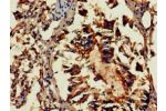 Immunohistochemistry of paraffin-embedded human lung tissue using CSB-PA892175LA01HU at dilution of 1:100