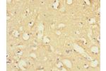 Immunohistochemistry of paraffin-embedded human brain tissue using CSB-PA892326ESR1HU at dilution 1:100