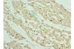 Immunohistochemistry of paraffin-embedded human heart tissue using CSB-PA892350ESR2HU at dilution 1:100