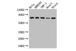 Western Blot<br />
Positive WB detected in:Hela whole cell lysate,HEK293 whole cell lysate,THP-1 whole cell lysate,Mouse heart tissue,Mouse brain tissue<br />
All lanes: FAF1 antibody at 2.8ug/ml<br />
Secondary<br />
Goat polyclonal to rabbit IgG at 1/50