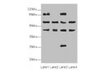 Western blot<br />
All lanes:FLVCR2 antibody at 0.89ug/ml<br />
Lane 1