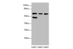 Western blot<br />
All lanes:FLVCR2 antibody at 0.83ug/ml<br />
Lane 1