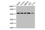 Western Blot<br />
Positive WB detected in:HepG2 whole cell lysate,Jurkat whole cell lysate,HEK293 whole cell lysate,K562 whole cell lysate,SH-SY5Y whole cell lysate,Mouse liver tissue<br />
All lanes: DCTN4 antibody at 3.4ug/ml<br />
Secondary<br />
Goat