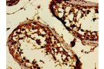 Immunohistochemistry of paraffin-embedded human testis tissue using CSB-PA892450LA01HU at dilution of 1:100
