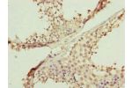 Immunohistochemistry of paraffin-embedded human testis tissue using CSB-PA892451ESR1HU at dilution of 1:100