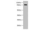 Western blot<br />
All lanes: ADAM28 antibody IgG at 5.6ug/ml+ PC-3 whole cell lysate<br />
Secondary<br />
Goat polyclonal to rabbit IgG at 1/10000 dilution<br />
Predicted band size: 88,62 kDa<br />
Observed band size: 87 kDa<br />
