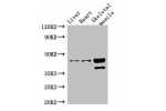 Western Blot<br />
Positive WB detected in:Mouse liver tissue,Mouse heart tissue,Mouse skeletal muscle tissue<br />
All lanes: ACAD8 antibody at 3ug/ml<br />
Secondary<br />
Goat polyclonal to rabbit IgG at 1/50000 dilution<br />
Predicted band size: 46,3