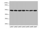 Western blot<br />
All lanes: