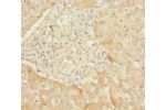 Immunohistochemistry of paraffin-embedded human liver tissue using CSB-PA892487ESR2HU at dilution 1:100