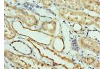 Immunohistochemistry of paraffin-embedded human kidney using CSB-PA896480ESR2HU at dilution 1:100