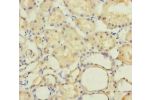 Immunohistochemistry of paraffin-embedded human kidney tissue using CSB-PA896481ESR2HU at dilution of 1:100