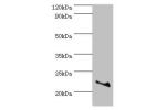 Western blot<br />
All lanes:ASF1A antibody at 2ug/ml<br />
Lane 1:Juekat whole cell lysate<br />
Lane 2:A431 whole cell lysate<br />
Secondary<br />
Goat polyclonal to rabbit at 1/10000 dilution<br />
Predicted band size: 23kDa<br />
Observed band size: 