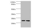 Western blot<br />
All lanes:ASF1A antibody at 2ug/ml<br />
Lane 1:Juekat whole cell lysate<br />
Lane 2:A431 whole cell lysate<br />
Secondary<br />
Goat polyclonal to rabbit at 1/10000 dilution<br />
Predicted band size: 23kDa<br />
Observed band size: 