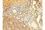 Immunohistochemistry of paraffin-embedded human tonsil tissue using CSB-PA896704LA01HU at dilution of 1:100
